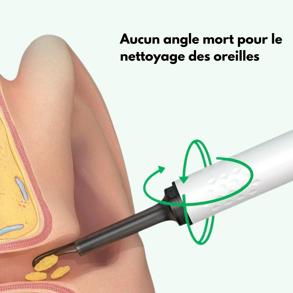 Oticlean™ - Élimine Le Cérumen Sans Risques