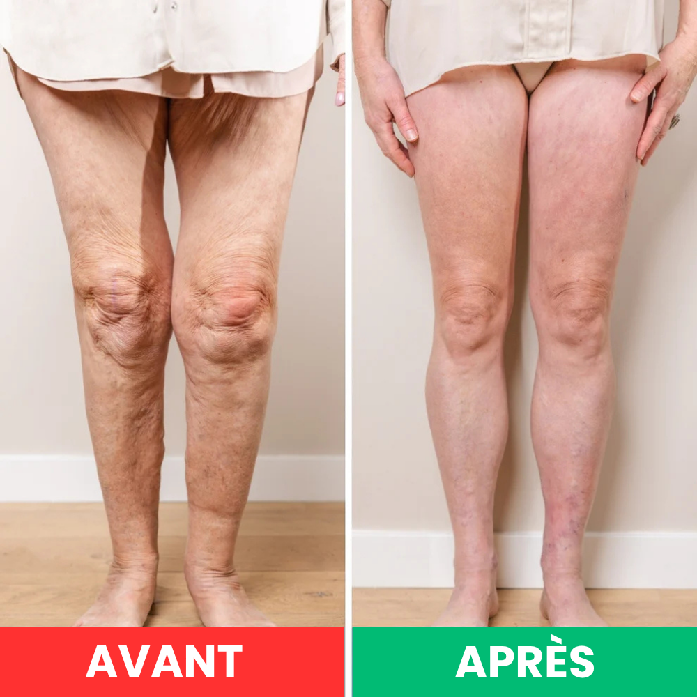NeuroPulse™ – Appareil de Massage Neuromusculaire