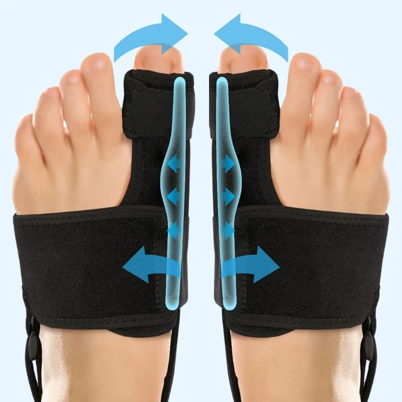 Valgux™ - Correcteur Hallux Valgus Sans Chirurgie