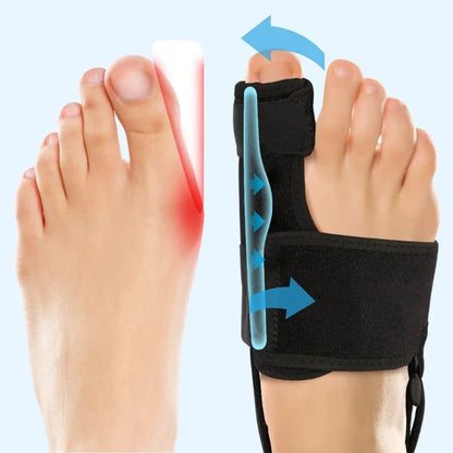 Valgux™ - Correcteur Hallux Valgus Sans Chirurgie