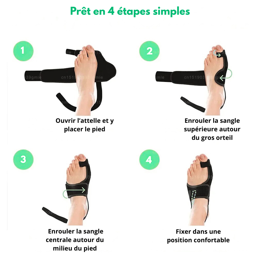 Valgux™ - Correcteur Hallux Valgus Sans Chirurgie