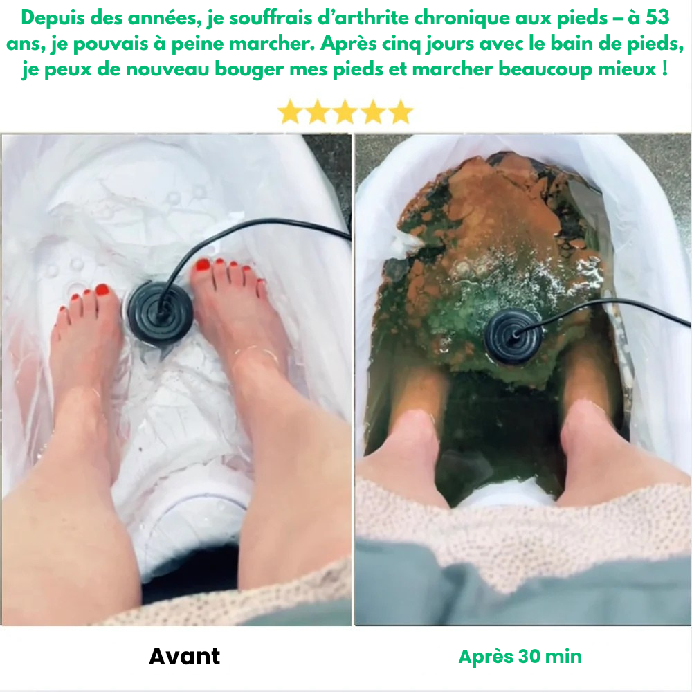 Feetox™ - Appareil Détoxifiant Ionique Pour Les Pieds